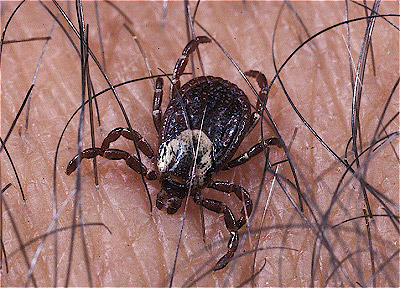 Wood Tick